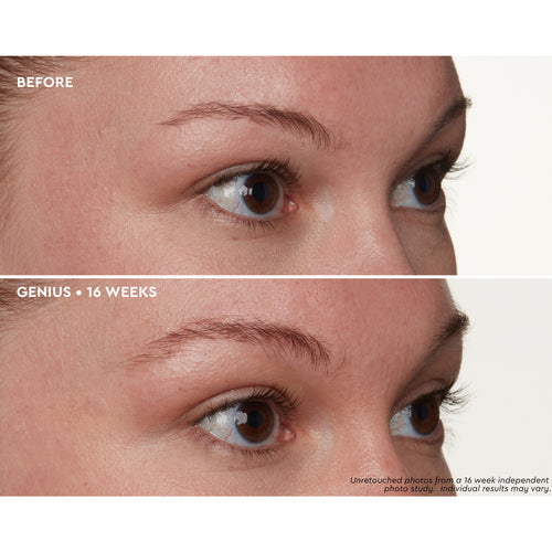 Brow Genius Before and After